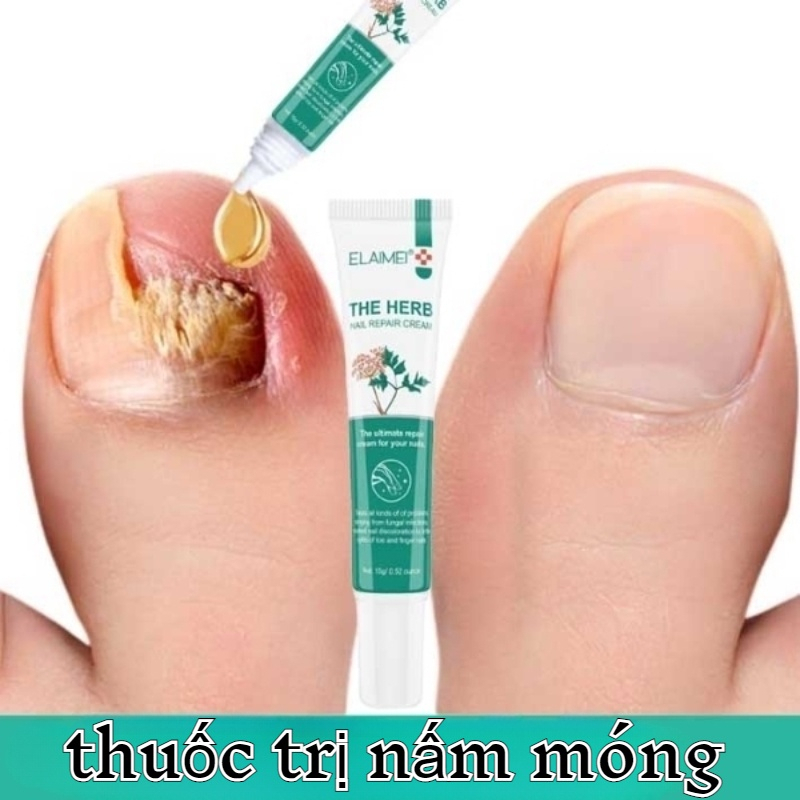 Kem nấm móng chân móng tay Nấm móng tay 15g Cải thiện vết nứt móng tay Kháng khuẩn Sửa chữa vết nứt móng tay