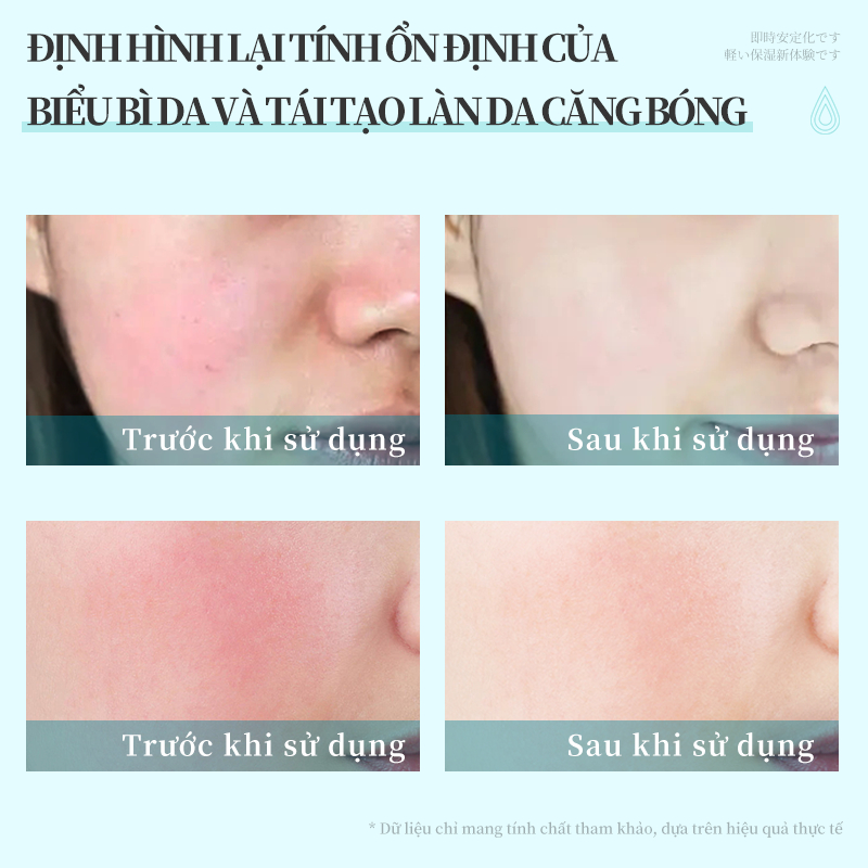 Dr.Lucel Provitamin B5 Serum Dưỡng ẩm lâu dài Vitamin B5 4% sáng da mờ vết thâm Cải thiện tình trạng da 37ml