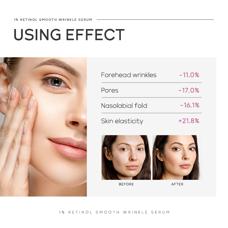 Tinh Chất 1% Retinol 17ml Chống Lão Hóa Làm Săn Chắc Và Sáng Da