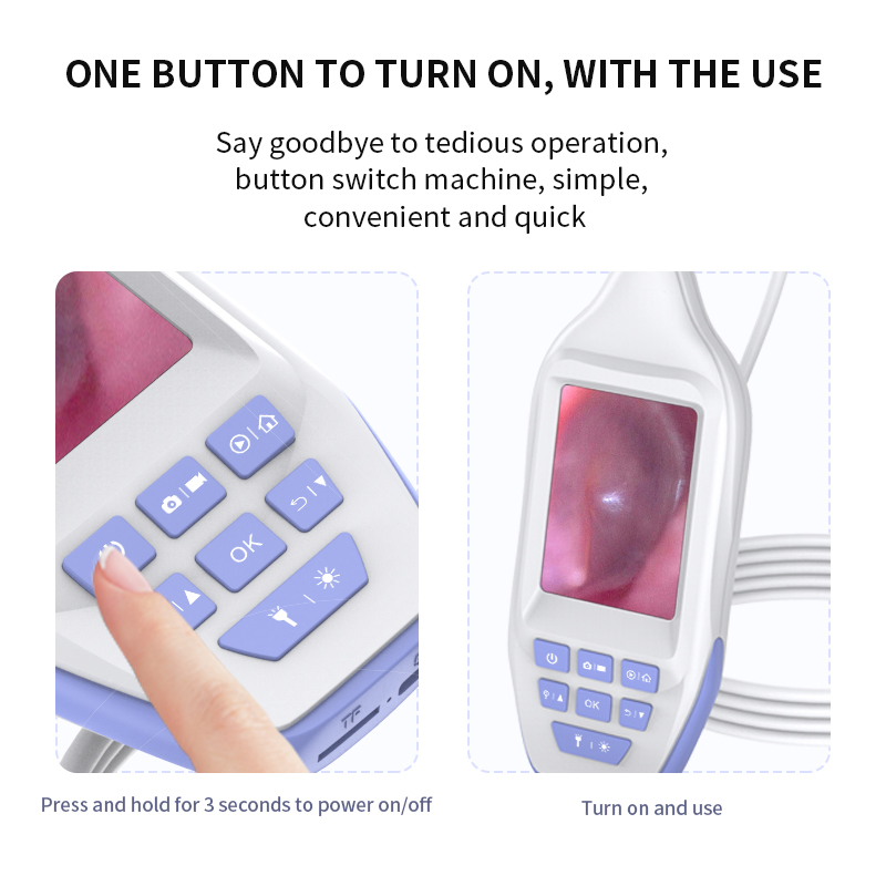 Máy Nội Soi Tai 3.9mm 1080P Kỹ Thuật Số Với Pin Sạc 3 "IPS 3000mAh