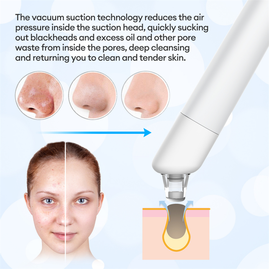 Ckeyin Máy Hút Mụn Đầu Đen Làm Sạch Sâu Lỗ Chân Lông