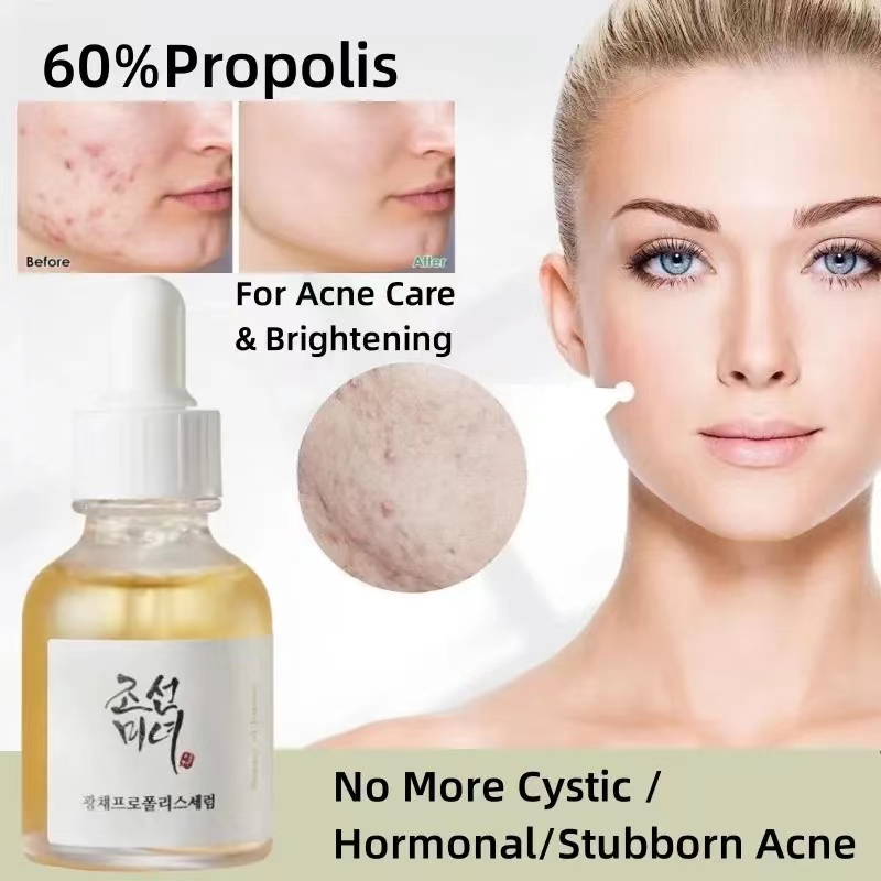 Tinh Chất Phục Hồi Và Làm Sáng Da Joseon: Keo Ong Và Niacinamide 30ml