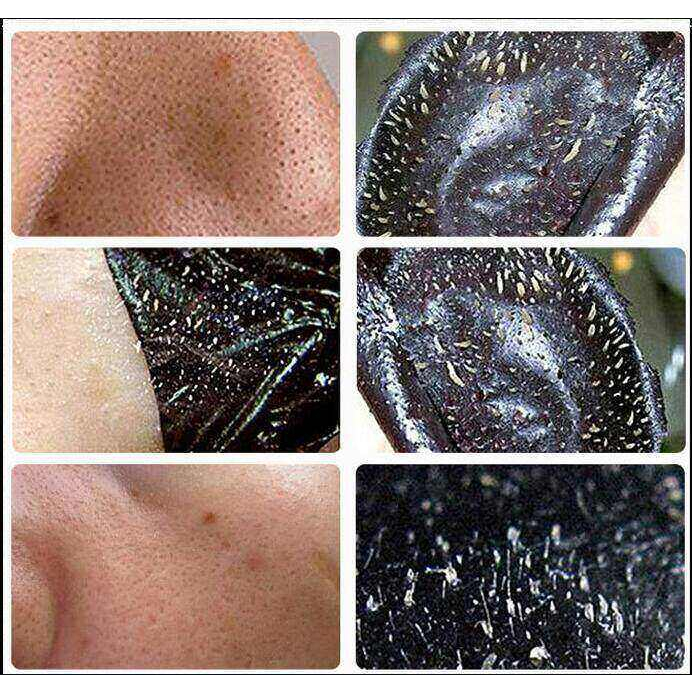 Mặt nạ tẩy mụn đầu đen skincare nose blackhead remover pore cleanser mask black head peel mask travel pack mặt nạ tẩy mụn đầu đen mặt nạ tẩy mụn đầu đen mặt nạ đen cho mặt bamboo charco