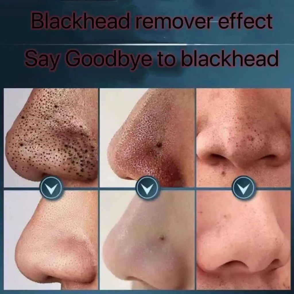 Mặt nạ tẩy mụn đầu đen skincare nose blackhead remover pore cleanser mask black head peel mask travel pack mặt nạ tẩy mụn đầu đen mặt nạ tẩy mụn đầu đen mặt nạ đen cho mặt bamboo charco