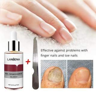 Tinh chất sửa chữa móng tay lanbena 15 ml
