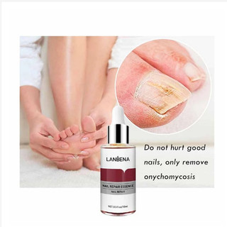 Tinh chất sửa chữa móng tay lanbena 15 ml