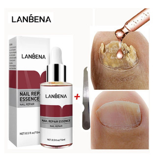 Tinh chất sửa chữa móng tay lanbena 15 ml