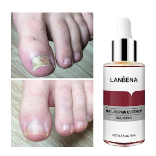 Tinh chất sửa chữa móng tay lanbena 15 ml