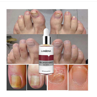 Tinh chất sửa chữa móng tay lanbena 15 ml