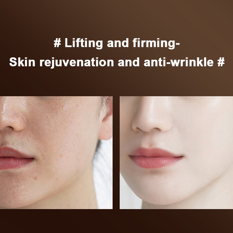 Máy mát xa mặt tinh chất cơ cổ và mặt đẩy căng da, loại bỏ nếp nhăn thúc đẩy collagen