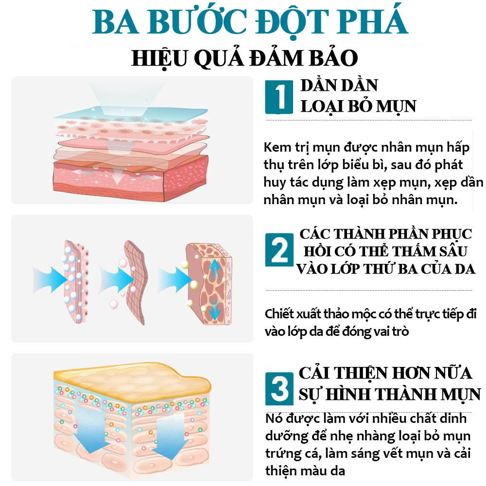 Kem chấm mụn Gel giảm mụn, giảm thâm ngăn mụn tái phát, kem bôi mụn làm mờ thâm mụn