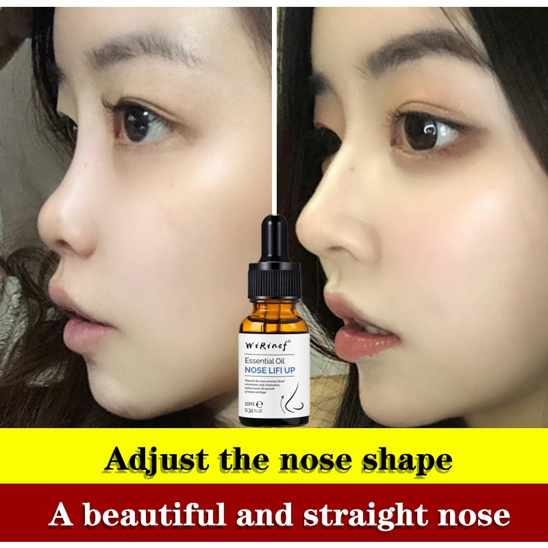 ⭐CHÍNH HÃNG⭐ Serum cao mũi 10ml tinh dầu nâng mũi săn chắc tạo dáng mũi tăng chiều cao sống mũi