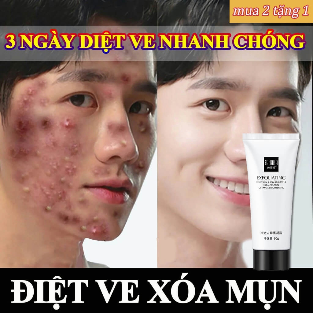 ⭐CHÍNH HÃNG⭐ Sữa rửa mặt làm trắng da nam da dầu,Sữa rửa mặt chứa axit amin dưỡng ẩm làm sạch dịu nhẹ dưỡng tẩy tế bào chết