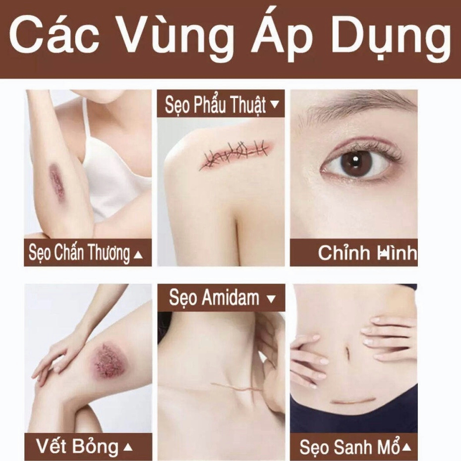 ⭐CHÍNH HÃNG⭐ Kem phục hồi sẹo Kem làm mờ vết sẹo kem chăm sóc sẹo 50g Khổi phục da bỏng và bỏng nước vết thương phẫu thuật sẹo thâm