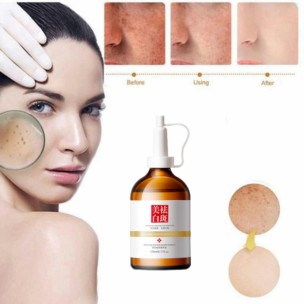 ⭐CHÍNH HÃNG⭐ kem nám tàn nhang Serum nám tàn nhang100ml Loại bỏ tàn nhang và làm trắng nhanh dưỡng ẩm làm sáng Chống lão hóa