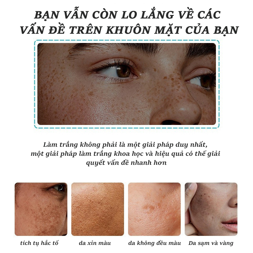 Kem trắng da mặt 50ml kem nám tàn nhang Kem trắng da và xóa tàn nhang Hiệu quả làm mờ thâm nám tàn nhan