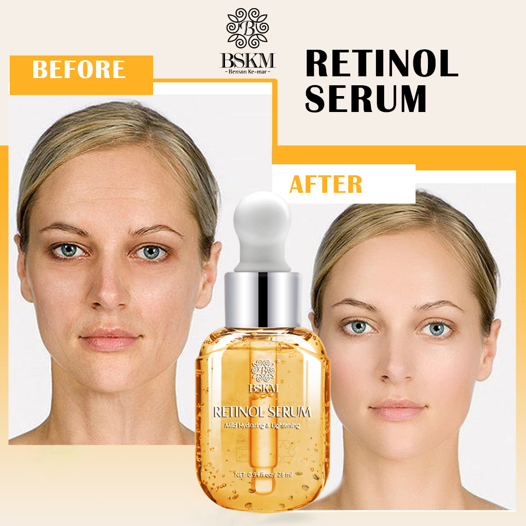 Bộ Re2 sản phẩm BSKM chống lão hóa retinol serum dưỡng da mặt/ mắt với con lăn giảm nếp nhăn làm trắng nâng da săn chắc