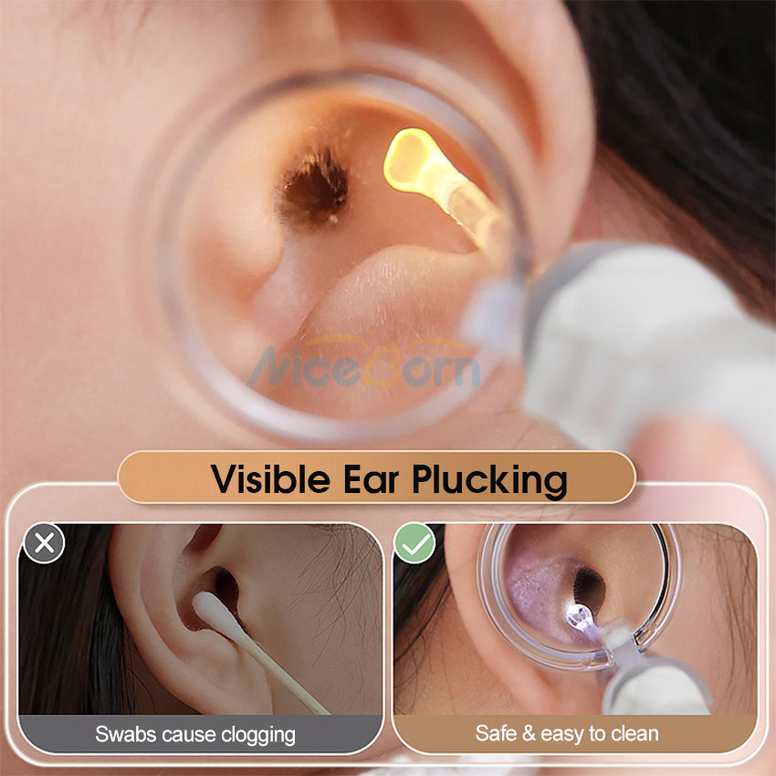 Niceborn ear pick nhíp phát sáng có thể sạc lại led ear spoon ear wax removal ear cleaner dụng cụ làm sạch tai an toàn dụng cụ làm sạch tai với 2 kính lúp 4 đầu thìa tai cho trẻ em người lớn