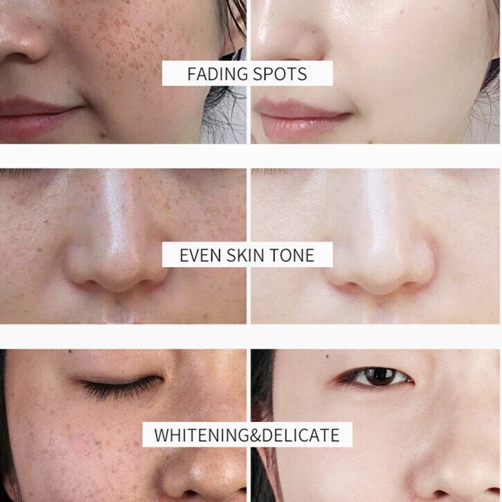 ⭐CHÍNH HÃNG⭐Tinh chất làm trắng sạch tàn nhang 20g*3 Kem trắng da và xóa tàn nhang, Hiệu quả làm mờ thâm nám tàn nhan, Kem nám tàn nhang