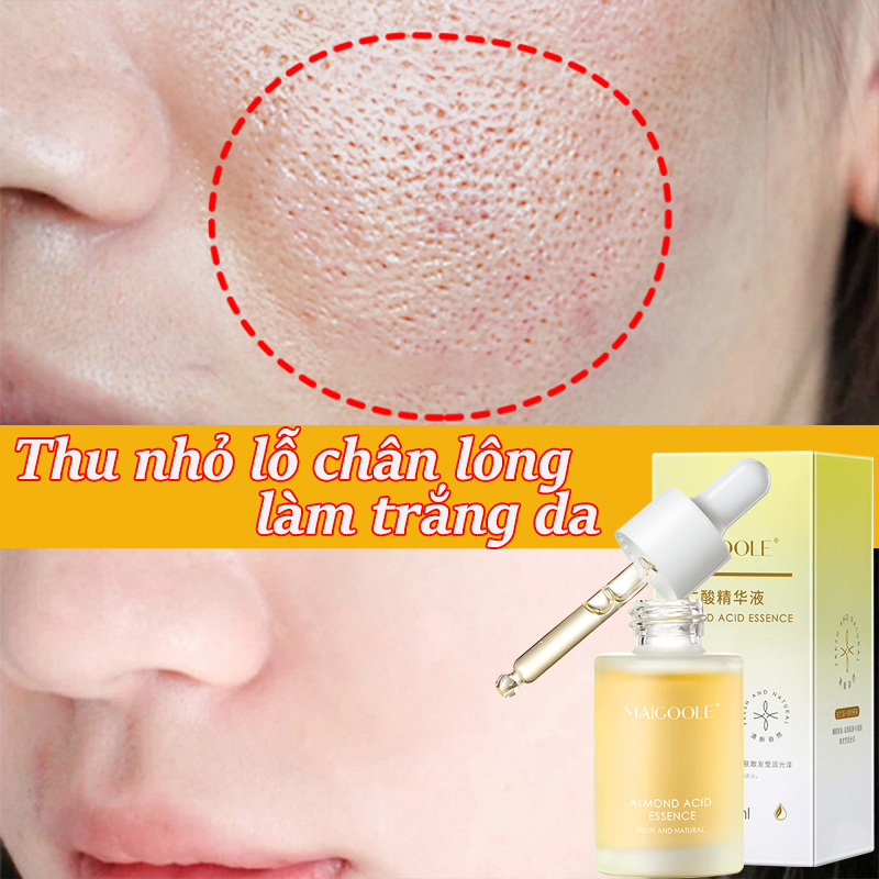 Serum trắng da Serum se khít lỗ chân lông 30ML lột mụn đầu đen se khít lỗ chân lông Mịn Màng Dưỡng Ẩm