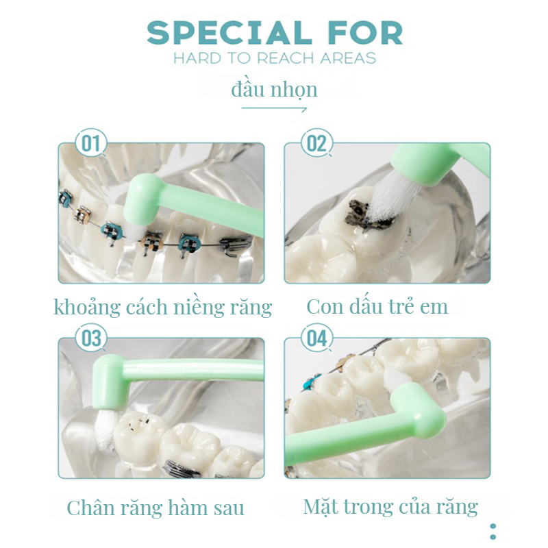 MEYARN Bàn chải kẽ răng Chỉnh nha Lông siêu mịn Tay cầm công thái học