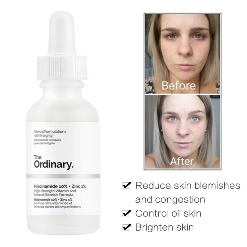 Tinh chất dưỡng The Ordinary Niacinamide 10% + Zinc 1% 30ml