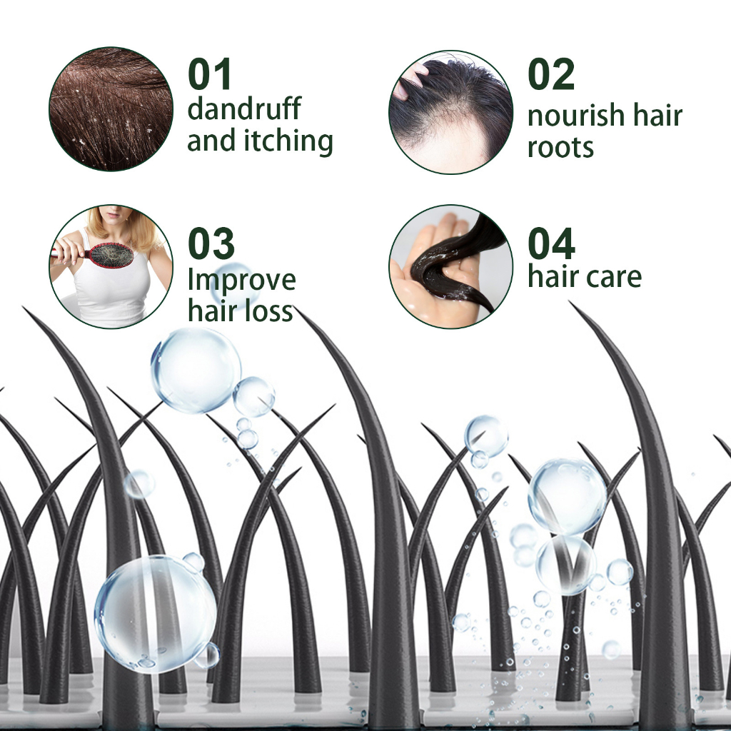Serum mọc tóc Tinh chất dưỡng tóc Tinh Chất Chống Rụng Tóc 30ml kích thích mọc tóc nhanh làm dày（Hiệu quả sau 7 ngày） giúp giảm rụng tóc  giải quyết vấn đề rụng tóc do lão hóa / hói đầu sau sinh