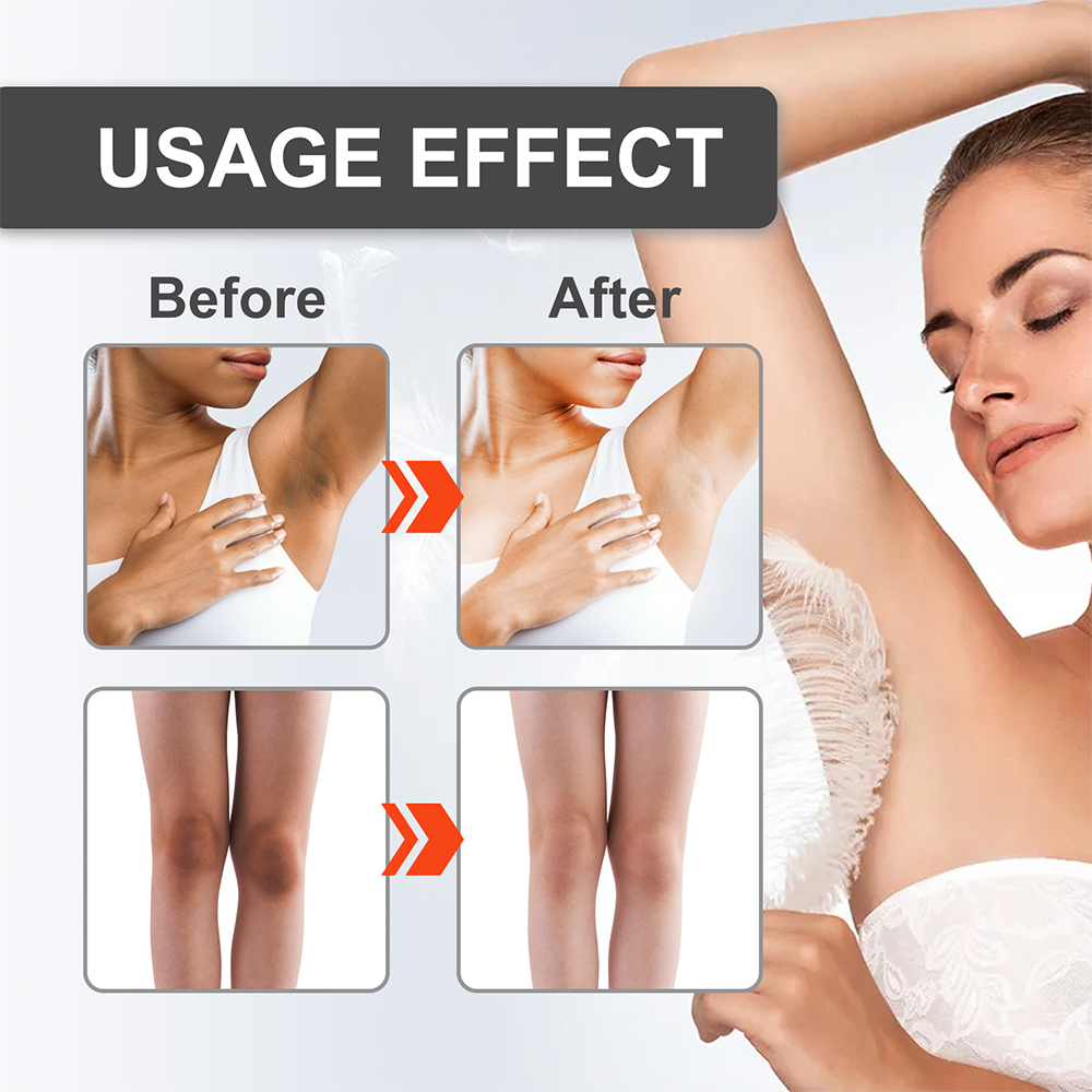 Kem Làm Trắng Da Vùng Kín Và Đầu Gối Làm Sáng Da