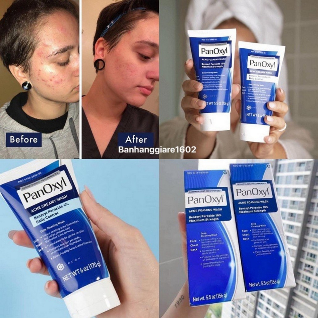 CHÍNH HÃNG✨ PanOxyl Acne Foaming Wash Benzoyl Peroxide 10% 156g Sữa rửa mặt cho da mụnMaximum Strength