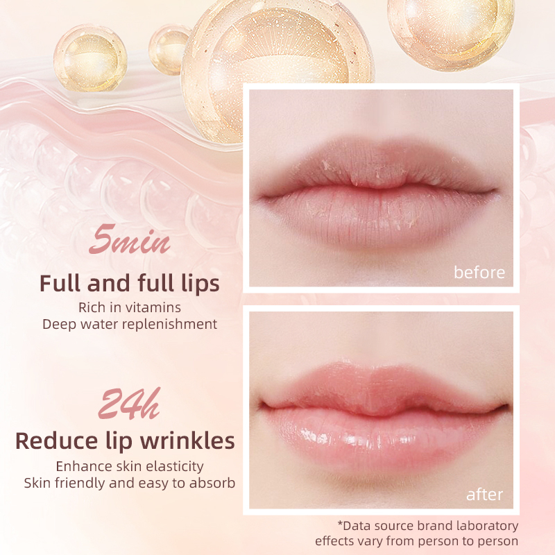 Novo Son Dưỡng Ẩm Chống Khô Môi Làm Mờ Đường Viền Môi no.novo5990