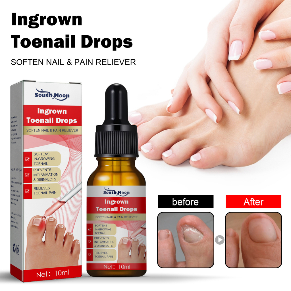 Tinh Chất Hỗ trợ giảm nấm Móng Chân Dưỡng Ẩm Làm Trắng Chăm Sóc Chân Tại Nhà