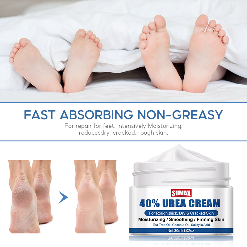 Urea Kem Dưỡng Ẩm Chống Nứt Nẻ Da Tay Chân Cho Nam Và Nữ