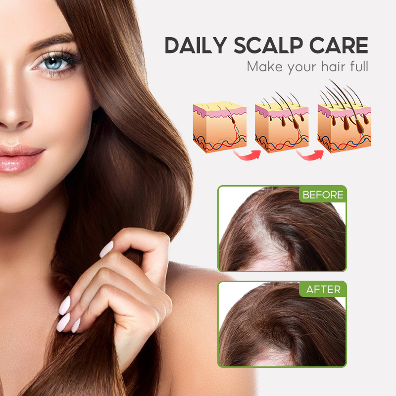 Tinh chất chăm sóc tóc RUOALL chiết xuất thiên nhiên giảm căng thẳng