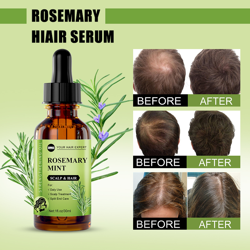 Tinh chất chăm sóc tóc RUOALL chiết xuất thiên nhiên giảm căng thẳng