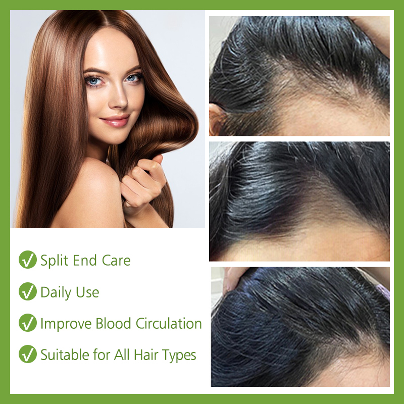 Tinh chất chăm sóc tóc RUOALL chiết xuất thiên nhiên giảm căng thẳng