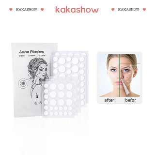 Kakashow Miếng dán mụn tái tạo chăm sóc làn da tiện dụng cao cấp HZMBB2151