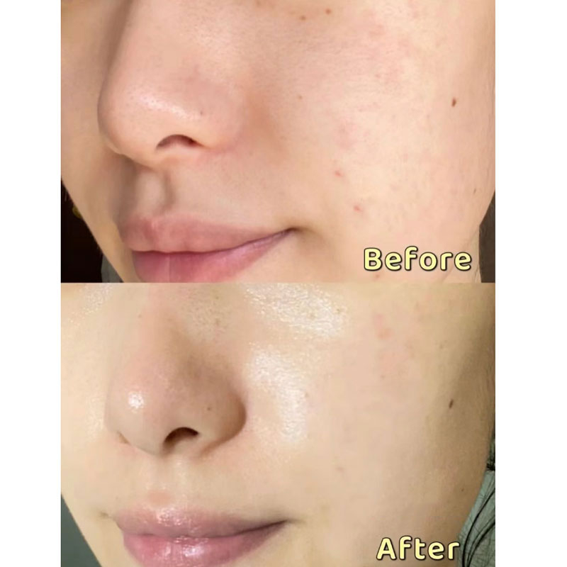 Fupei morning c and morning serum Dưỡng Ẩm Làm Sáng Tông Màu Da Mặt - arbutin Cải Thiện Nước Se Khít Lỗ Chân Lông vc