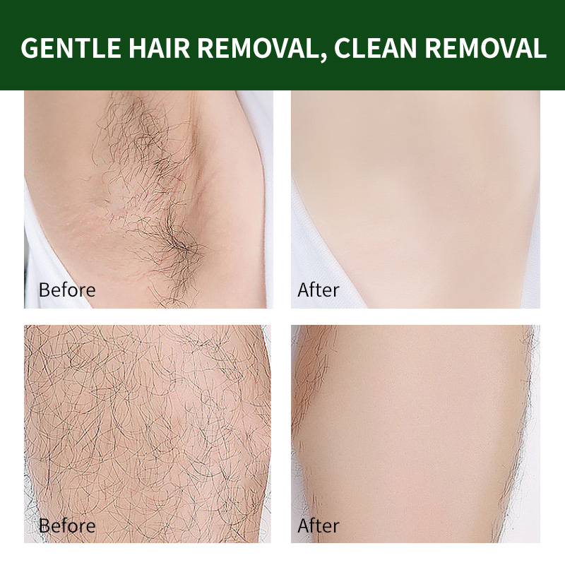 Aloe Kem Tẩy Lông Chiết Xuất Từ Lô Hội Dành Cho Nam Và Nữ