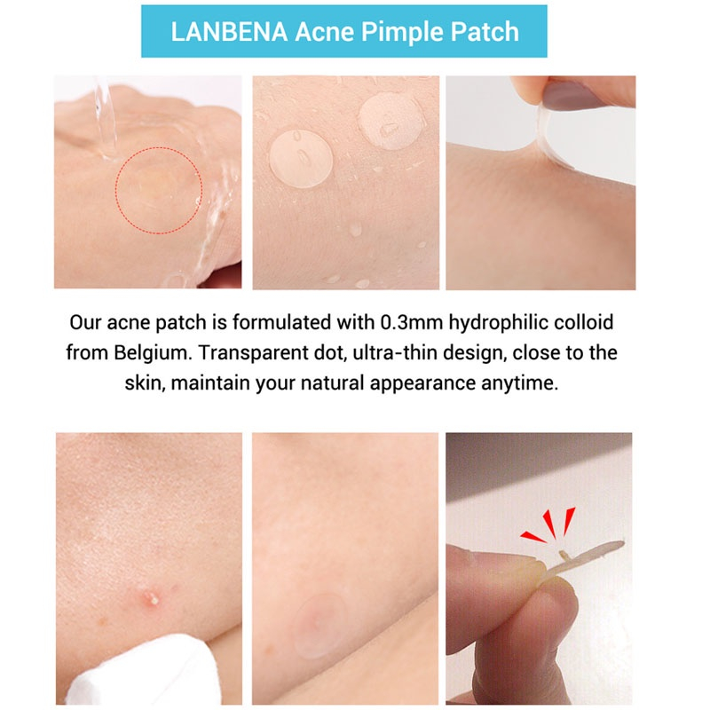 Lanbena Set 28 Mặt Nạ Hỗ Trợ Giảm Mụn Vô Hình Dùng Hàng Ngày Và Ban Đêm