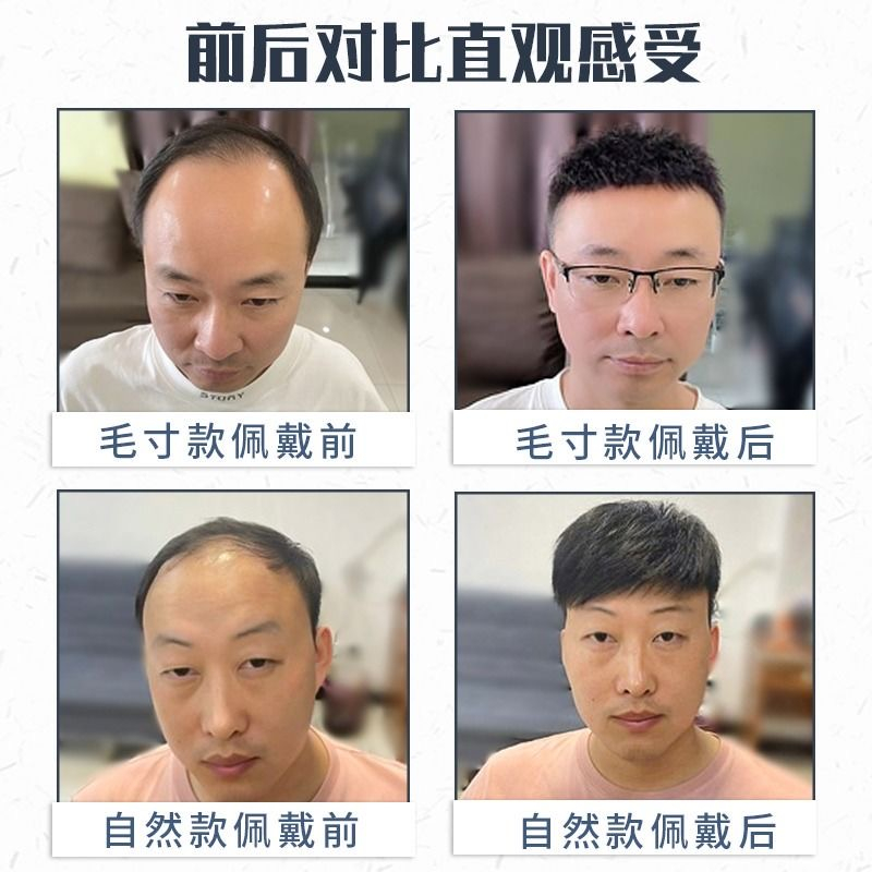 Bộ Tóc Giả Ngắn Tự Nhiên Màu Đen Cá Tính Cho Nam