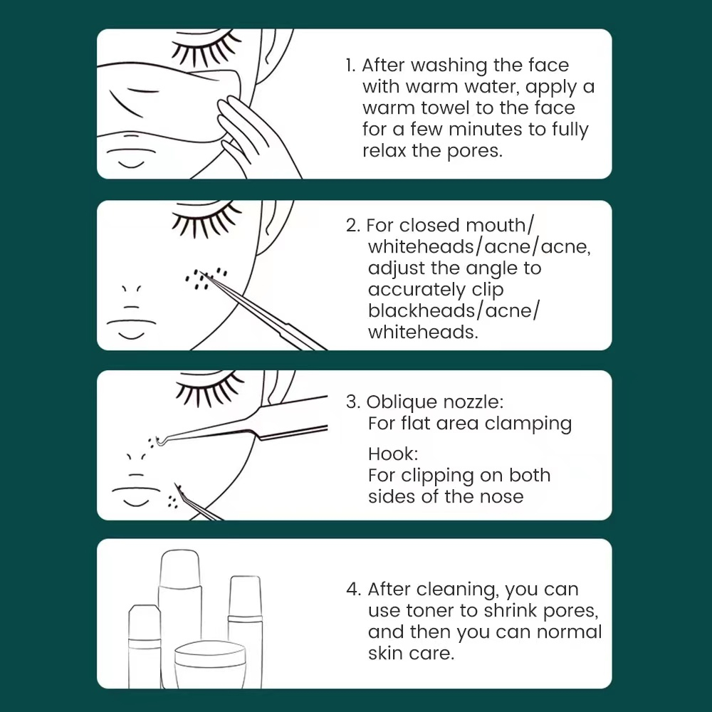 Bộ 3 Nhíp Nặn Mụn Đầu Đen Bằng Inox Chuyên Dùng