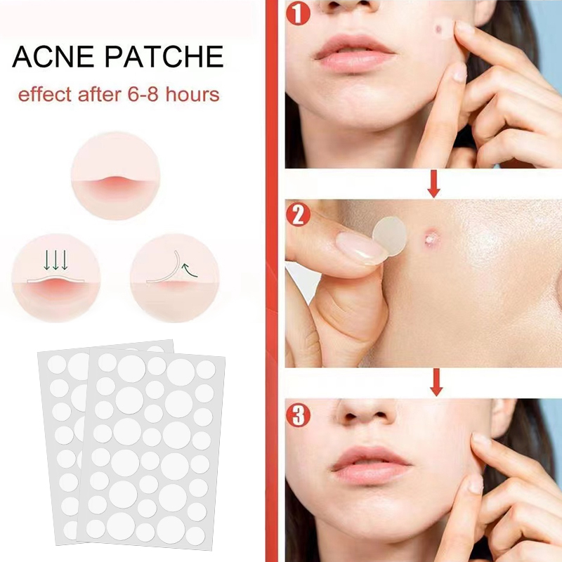 🔮Bộ 36 miếng dán Ngôi sao loại bỏ mụn chăm sóc da chuyên dụng