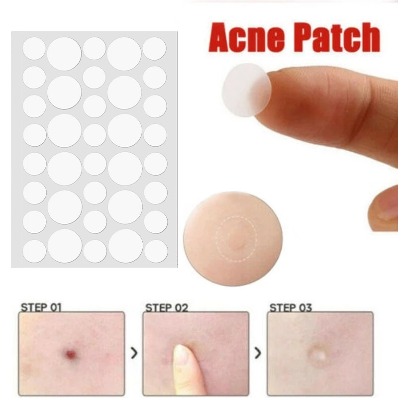 🔮Bộ 36 miếng dán Ngôi sao loại bỏ mụn chăm sóc da chuyên dụng