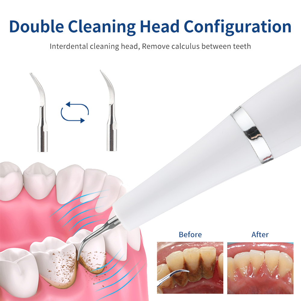 Máy Cạo Răng Bằng Sóng Siêu Âm Loại Bỏ Mảng Bám Làm Sạch Răng Miệng