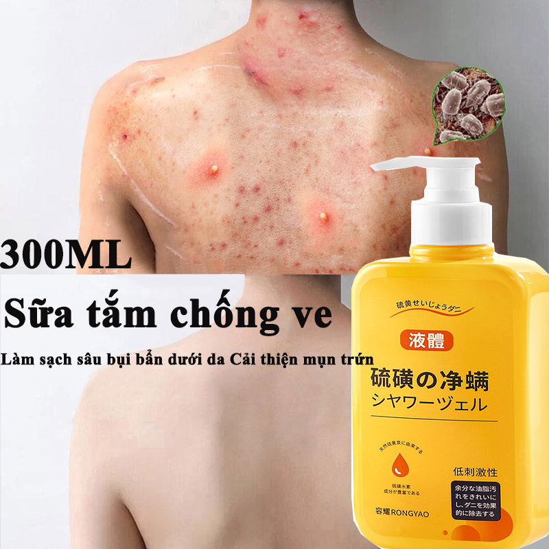 ⭐CHÍNH HÃNG⭐ Sữa tắm chống ve Sữa tắm loại bỏ mụn sữa tắm trắng da 300ml Làm sạch sâu bụi bẩn dưới da Cải thiện mụn trứn.