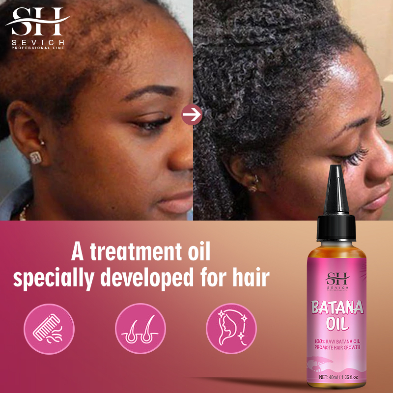 Dầu và mặt nạ tóc bơ Batana SEVICH nguyên chất 100% bôi trơn giúp tóc chắc khỏe/chống gãy rụng cho mái tóc dài đầy đặn