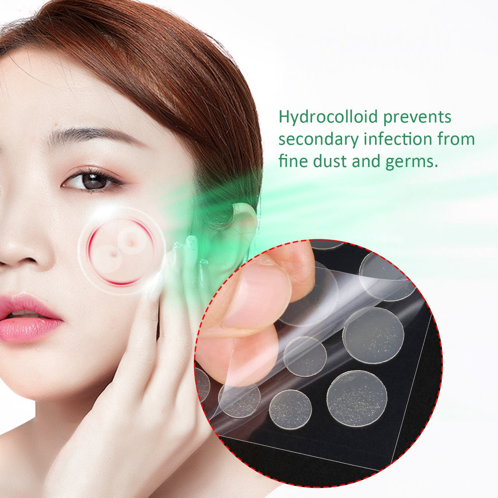 Miếng Dán Mụn Cosrx Acne Pimple Master Patch