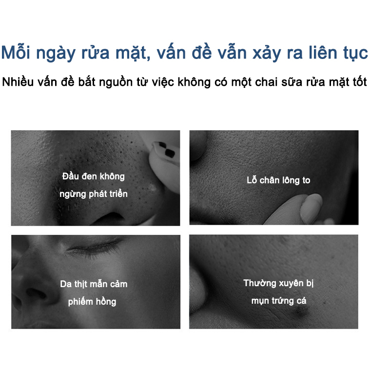 Sữa rửa mặt axit amin YIMIAOSI 500g làm sạch nhẹ nhàng chứa niacinamide
