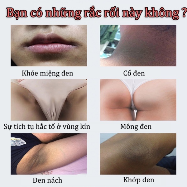 Kem làm trắng da vùng dưới cánh tay Kem làm trắng âm đạo làm sáng da đầu gối vùng da àm trắng mông cổ vùng đùi 50g