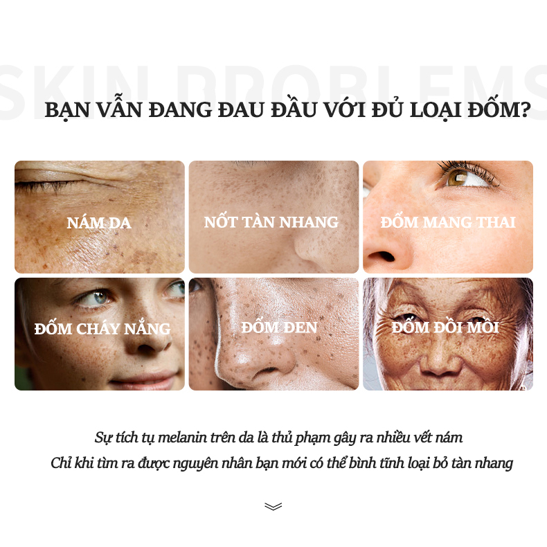 Kem trắng da và xóa tàn nhang Kem nám tàn nhang 20g kem dưỡng trắng da mặt Hiệu quả làm mờ thâm nám tàn nhan se khít lỗ châ